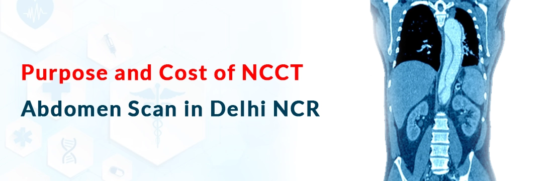 Purpose and Cost of NCCT Abdomen Scan in Delhi NCR